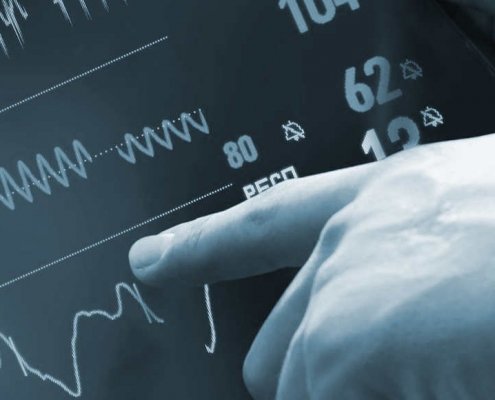 ecg biomedical iot ECG digital signal processing, ECG_reference_IPblocks baseline wandering noise reduction 50hz cancellation Savitzky-Golay Filter biomedical signal analysis, ECG signal procssing, ECG DSP